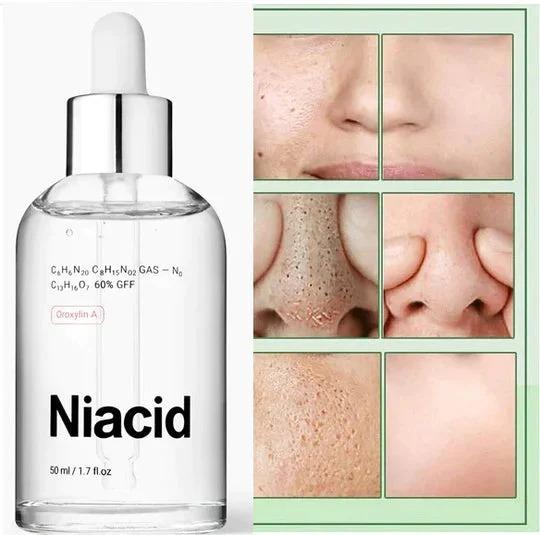 Niacid Face Serum |Skincare